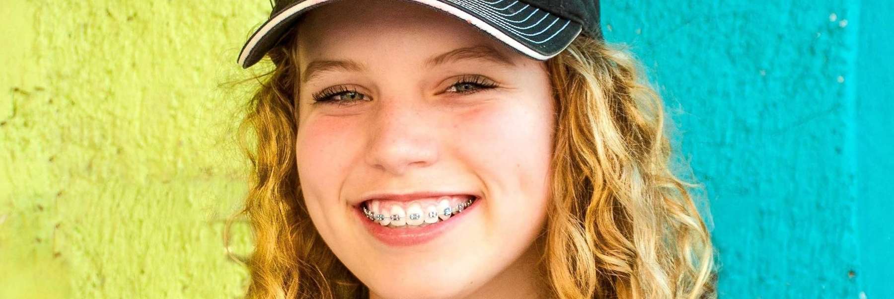 Braces