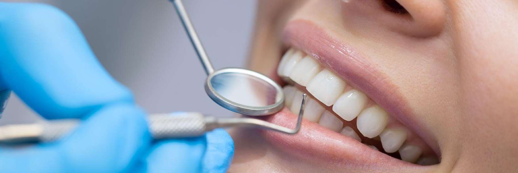 Dental Regular Checkups