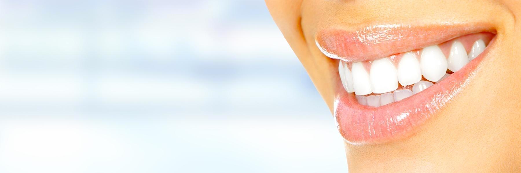 girl wearing invisalign clear aligners in jensen beach fl